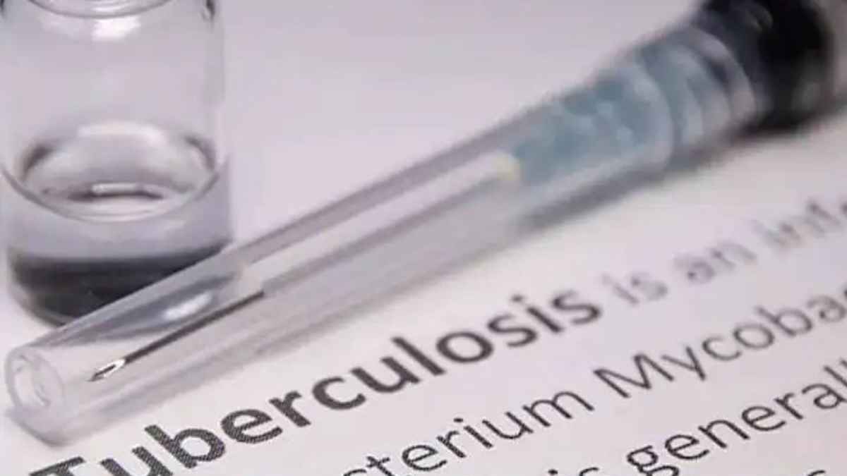 Tuberculosis
