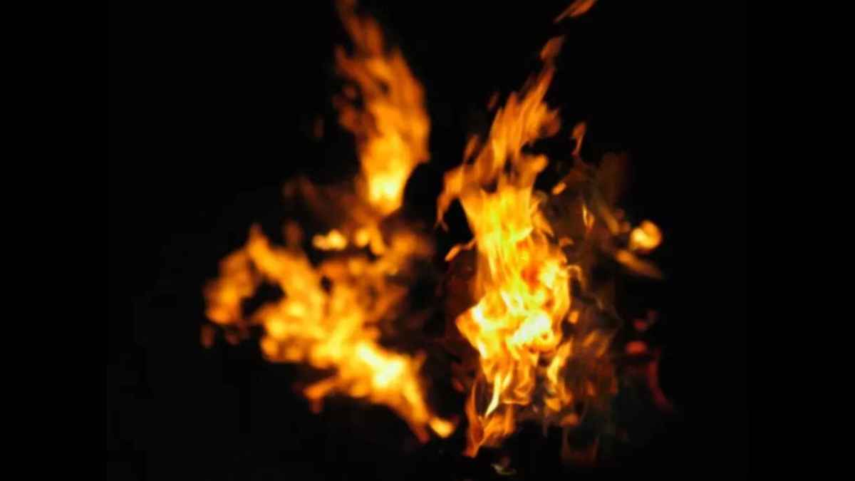 person burnt in fire